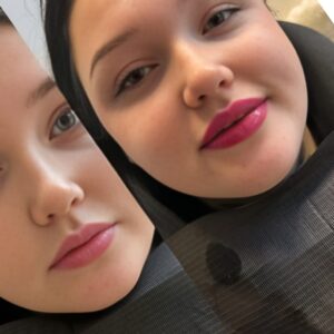 1-to-1 Combined Injectables Training